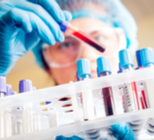 פענוח בדיקות מעבדה:  תפקודי כליות, בדיקות הורמונים וברזל-תמונה